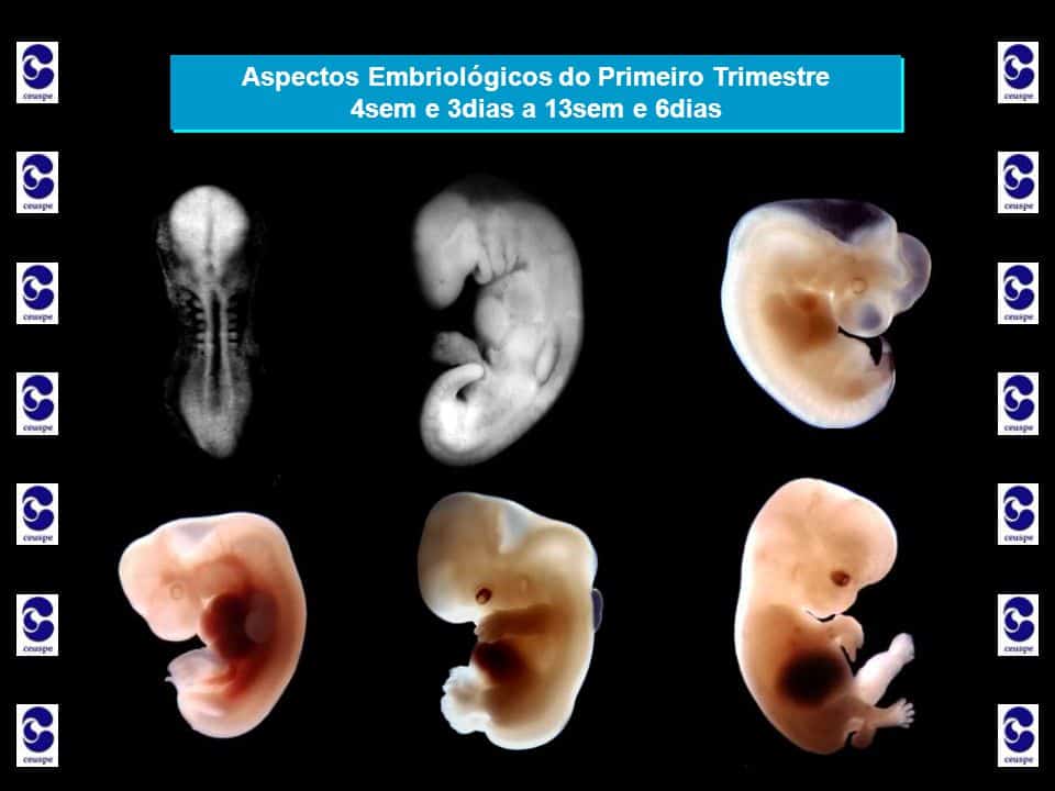 Gravidez Primeiro Trimestre 