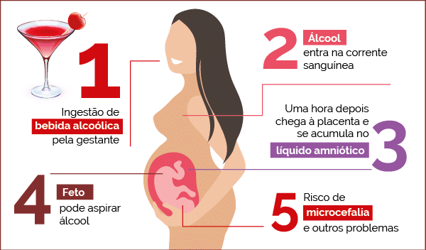 Síndrome Alcoólica Fetal 